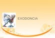 Expo exodoncia