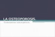 Osteoporosis Carlos Gallardo