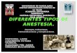 Diferentes tipos de anestesia