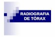 Radiografia De TòRax [Modo De Compatibilidad]
