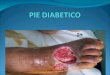 Pie diabetic ocopia