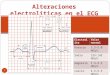 Alteraciones electrolíticas en el electrocardiograma