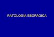 Patologia Esofagica Dr. Llewelyn