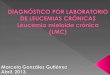 Diagnóstico por laboratorio de leucemias crónicas - Leucemia mieloide crónica LMC