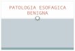 Patología benigna de esofago