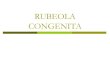 Rubeola congenita,hb,tpc