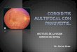 Coroiditis multifocal con_panuveitis