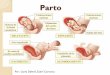 Parto - Puerperio - Repercusiones en el Embarazo