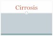 Fisiopatología de la cirrosis hepática
