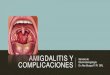 Amigdalitis y complicaciones