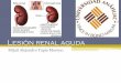 Lesión renal aguda (insuficiencia renal aguda)