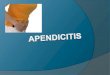 Apendicitis Belkis