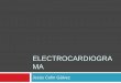 Electrocardiograma básico e IAM