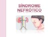 Sindrome nefrótico y nefrítico