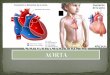 Coartacion de la aorta  expo-cardio-final