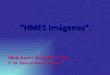 Presentación de HMES
