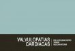 Valvulopatias cardiacas