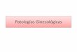 Patologías ginecológicas