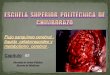 Flujo sanguíneo cerebral , líquido  cefalorraquídeo y metabolismo  cerebral   capitulo 61