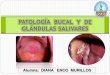 Patologia bucal y de glandulas salivales