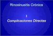 Rinosinusitis Crónica I - Complicaciones Directas