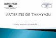 Arteritis de takayasu