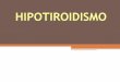 11. hipotiroidismo