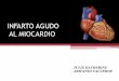 Infarto Agudo al Miocardio/ Fisiología Cardiovascular