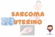 Sarcomas uterinos