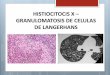 Histiocitosis x langerhans