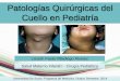 Patologías quirúrgicas de cuello en pediatría
