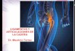 Ligamentos y articulaciones de cadera, aplicación clínica: hernia inguinal