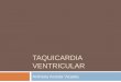 Taquicardia ventricular: electrocardiograma