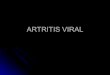 Artritis viral