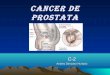 Cancer de prostata c-2