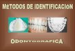 MéTodos De IdentificacióN Odontografica