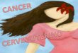 Cancer de utero (eli)