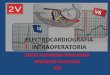 Electrocardiografia intraoperatoria 1