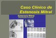 Caso clínico de Estenosis Mitral