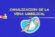Canalizacion Umbilical