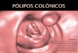 Pólipos Colon