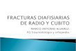 Fracturas diafisiarias radio y cubito