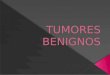 Tumores benignos (1)