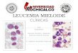 Leucemia mieloide aguda y crónica