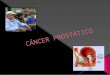 Charla cancer prostatico