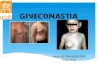 Ginecomastia en Pediatría