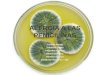 Alergia a las penicilinas: generalidades, reactividad cruzada, tratamiento y alternativas terapéuticas