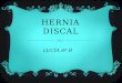 Hernia discal (lucía)