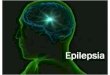 Epilepcia chele