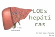 Aproximación diagnóstica a las LOEs hepáticas